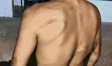 भाजपा नेता ने युवक को बेरहमी से पीटा,बिजली कटौती की शिकायत गलत नंबर पर की:फोन लगने पर दुकान में बंदकर की मारपीट