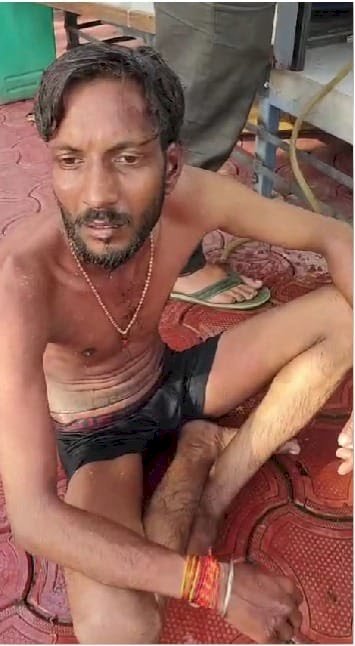 व्यापारी ने खुद को लगाई आग, 10 नंबर मार्केट में अतिक्रमण हटाने की कार्रवाई के बीच हंगामा -व्यापारियों में आक्रोश