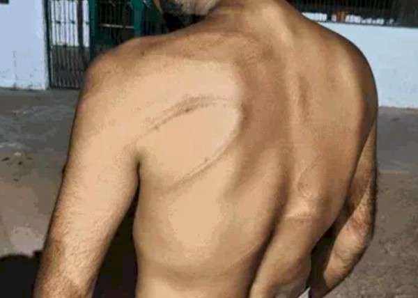 भाजपा नेता ने युवक को बेरहमी से पीटा,बिजली कटौती की शिकायत गलत नंबर पर की:फोन लगने पर दुकान में बंदकर की मारपीट