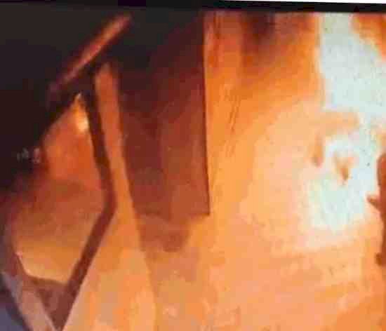 फाइनेंस कंपनी से परेशान युवक ने ऑफिस में खुद को लगाई आग, 90 प्रतिशत झुलसा; परिजनों ने लगाया प्रताड़ना का आरोप