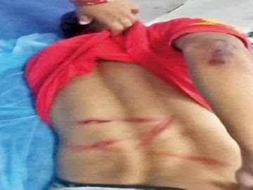 MLA रेस्ट हाउस के बाहर आधी रात हंगामा, विधायक पुत्र की शिकायत पर गिरफ्तारी, दूसरे पक्ष ने पुलिस पर उठाए सवाल